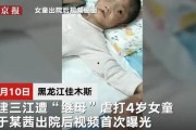 小李打白面爆料视频,白面内幕视频曝光，震惊业界
